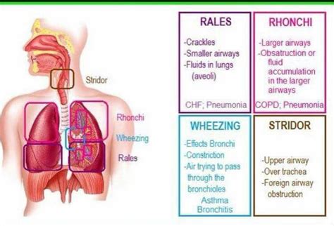 Breath Sounds Nursing Assessment Nursing Mnemonics Icu Nursing