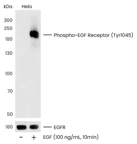 Recombinant Anti Egfr Tyr1045tyr1069 Antibody Rabbit Mab 110840 R0002 Sino Biological