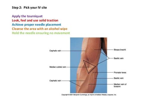 Iv Insertion