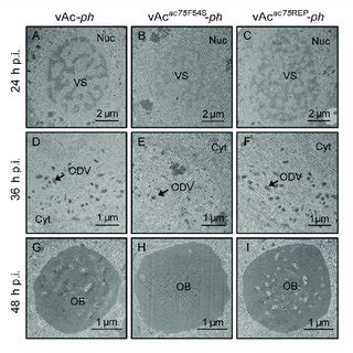 Tem Analysis Of Cells Infected With Vac Ph Vac Ac F S Ph Or Vac