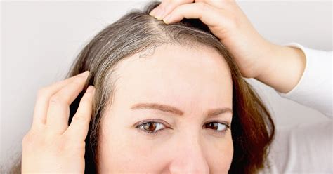 What Causes Premature Gray Hair At Young Age Reasons