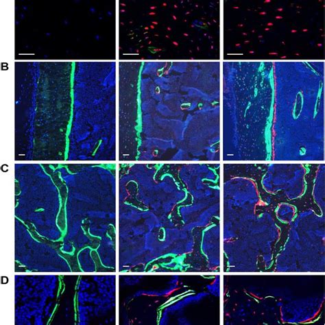 Anaylsis Of Sost Cre Transgenic Mice Using Tdtomato Cre Reporter