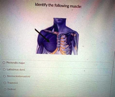 Solved Identify The Following Muscle Pectoralis Major Latissimus