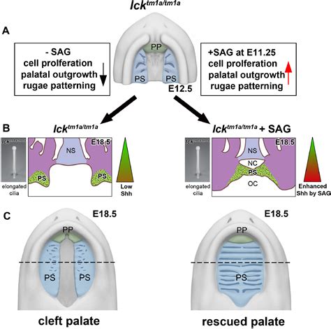 Activation Of Sonic Hedgehog Signaling By A Smoothened Agonist Restores