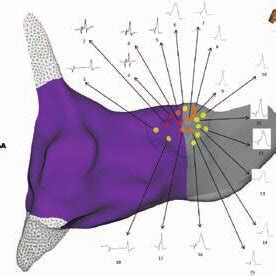 Three Dimensional Electroanatomical Map Of The Hb Cloud The Sites