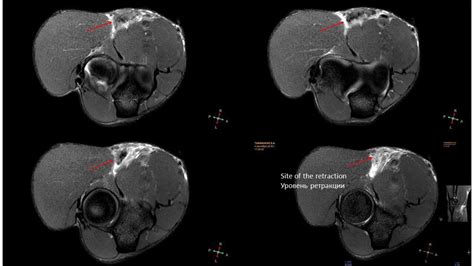 Radiogyan Radiology Made Easy