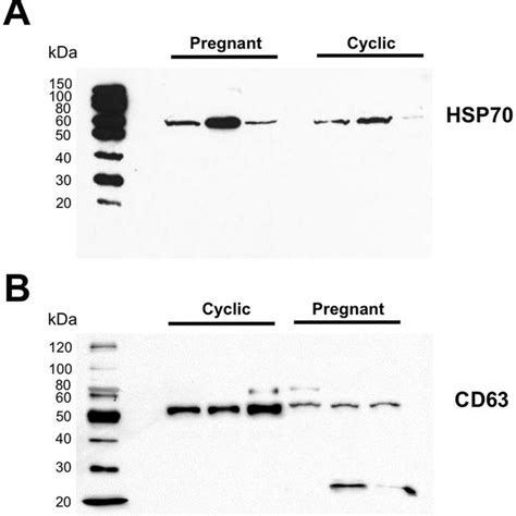 Western Blot Showing Presence Of Hsp70 And Cd63 In Ulf Derived