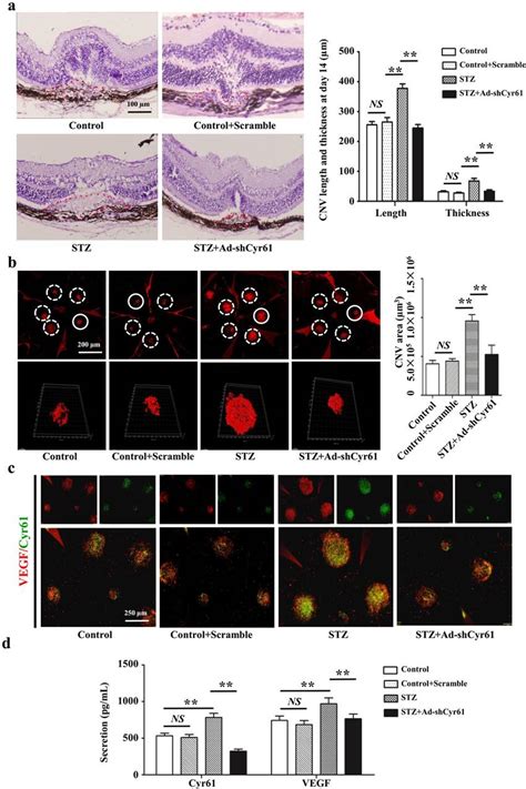 Cyr61 Knockdown Suppresses Vegf Expression And Alleviates The Leakage