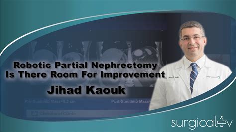 Jihad Kaouk Robotic Partial Nephrectomy Is There Room For