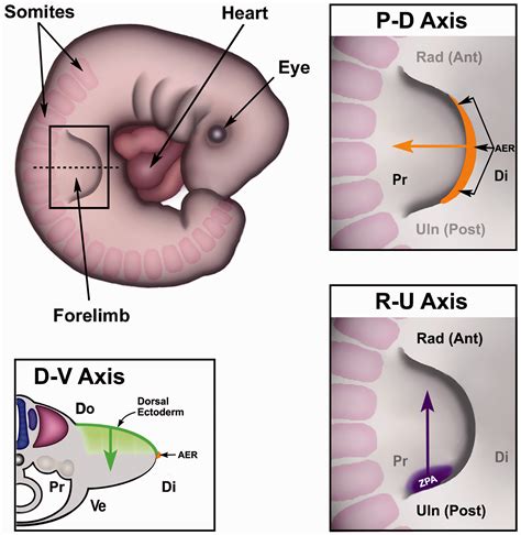 Classification Of Congenital Upper Limb Anomalies Towards Improved Communication Diagnosis