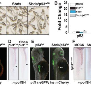 Loss Of P53 Does Not Rescue Sbds Organogenesis Defects A The Body