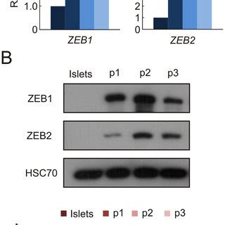 Induction Of ZEB Expression During Islet Cell Dedifferentiation A