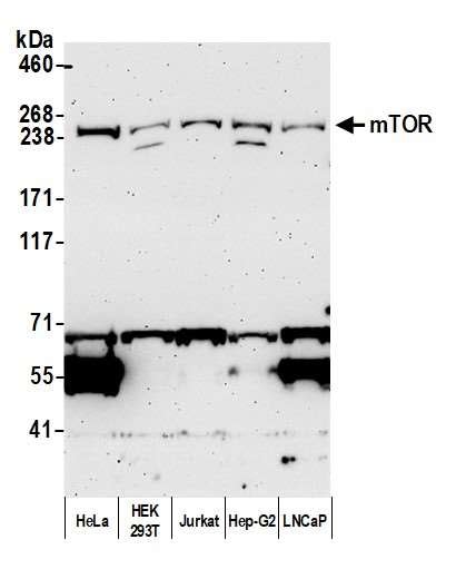 Anti Mtor Antibody Leinco Technologies