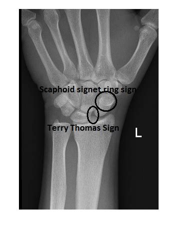 Imaging Case Of The Week Answer Emergucate