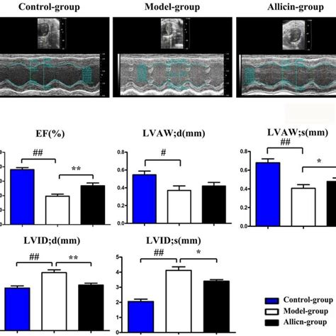 Allicin Improved Cardiac Function In Mice After Myocardial Ir Injury