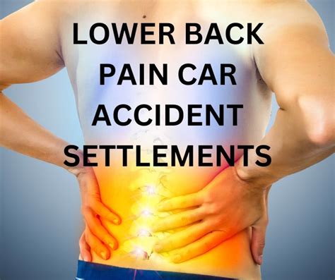 Maximizing Your Settlement For Lower Back Pain After A Car Accident