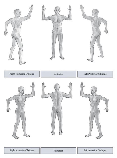 Patient Positions For Total Skin Electron Beam Therapy Field