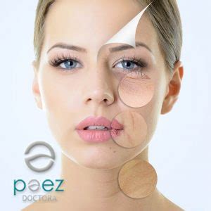 Cl Nica Doctora Paez Peeling Tca Con Cido Tricloroac Tico