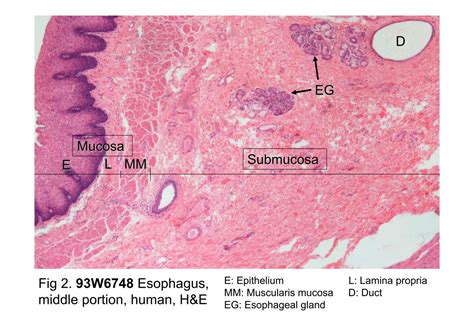 Block10 1fig 2 93w6748 The Microscopic Structure Of The Esophagus