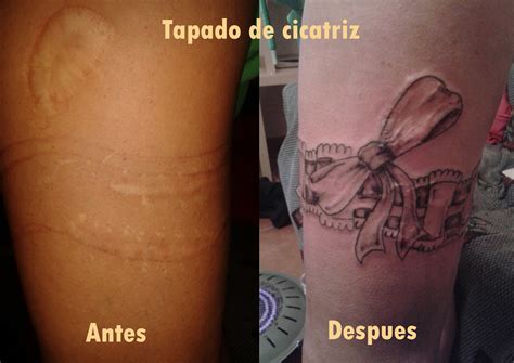 Secretos De Los Tatuajes Cubir Cicatrices