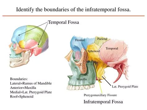 Ppt Identify The Boundaries Of The Infratemporal Fossa Powerpoint