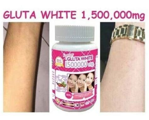 6x Supreme Gluta White 150000mg Glutathione Skin Whitening 30 Softgel