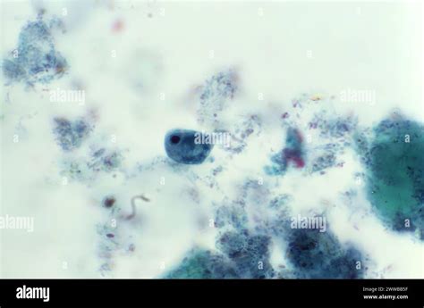 This Photomicrograph Of A Trichrome Stained Specimen Revealed The Presence Of A Parasitic