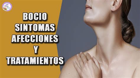 Bocio Sintomas Afecciones Y Tratamiento Youtube