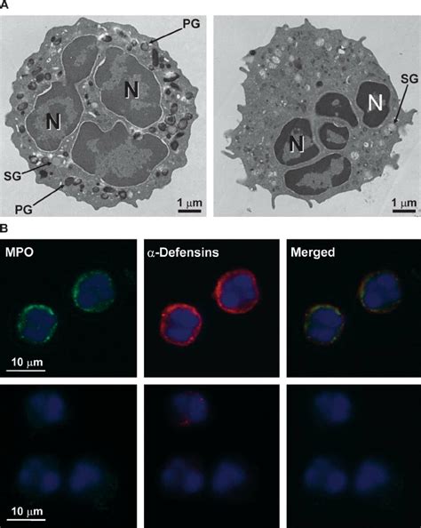 Characterization of neutrophil degranulation with electron and confocal...