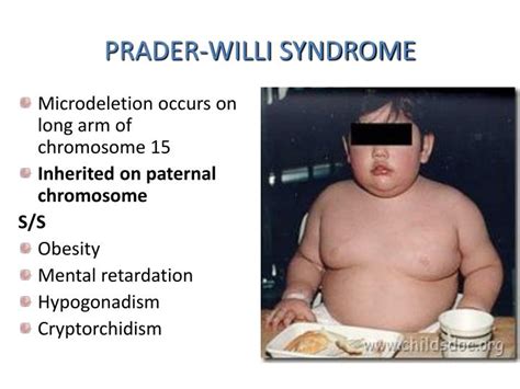 PPT CHROMOSOMAL ABNORMALITIES PowerPoint Presentation ID 5719987