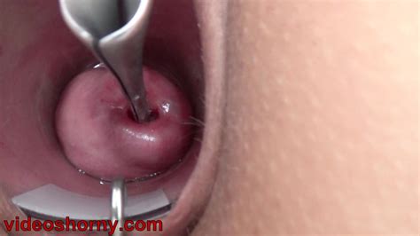 Extreme Cervix Play With Insertion Chain In Uterus Eporner