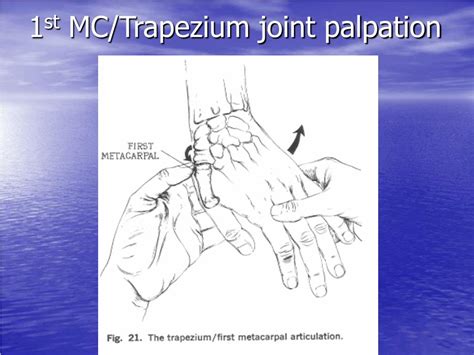 Ppt Clinical Examination Of The Hand And Wrist Powerpoint