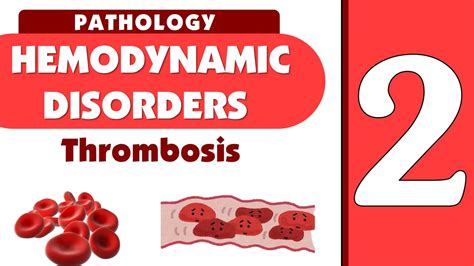 Hemodynamics Lecture 2 Thrombosis Part 2 YouTube