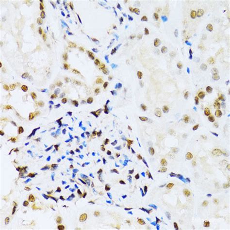 High Affinity And Specificity KO Validated MAPK3 Polyclonal Antibody