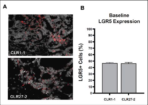 Human Crc Xenografts Demonstrate Expansion Of The Lgr Stem Cell