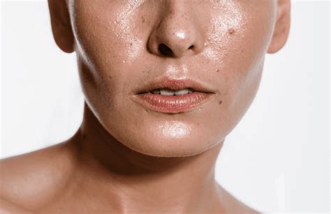 Oily Skin Causes Effects Treatments Ensoul Medical Clinic