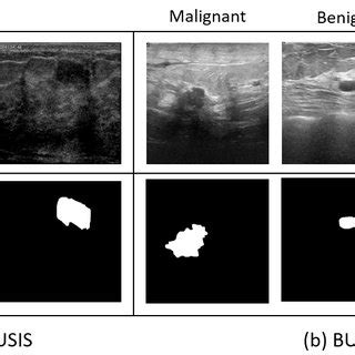 Breast Ultrasound Images With Ground Truth From A BUSIS And B BUSI