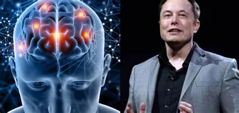 Neuralink Seeks Patients For Elon Musks Human Experiment