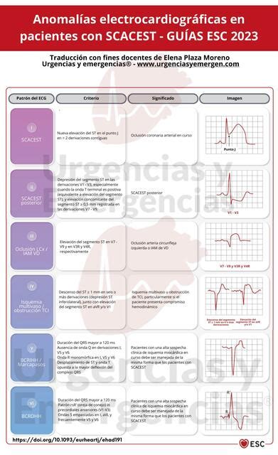 SCA Alteraciones Electrocardiograficas En Paciente Mariestefany