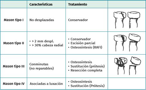 Fracturas Del Extremo Proximal De Cúbito Y Radio Fondoscience