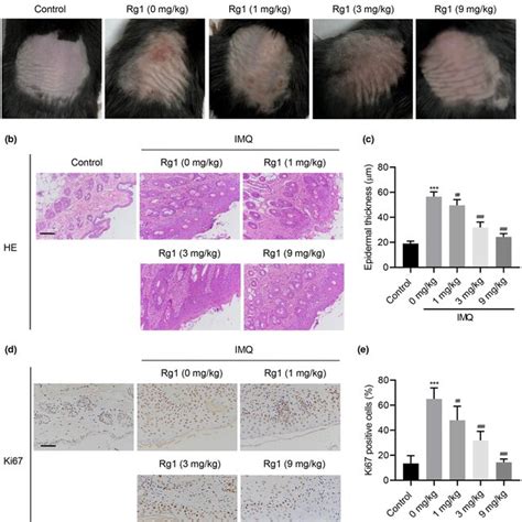 Ginsenoside Rg1 Inhibits IMQinduced Pathology And Proliferation In