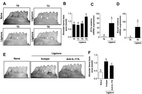 Il 17a Expression And The Development Of Ligature Induced Download