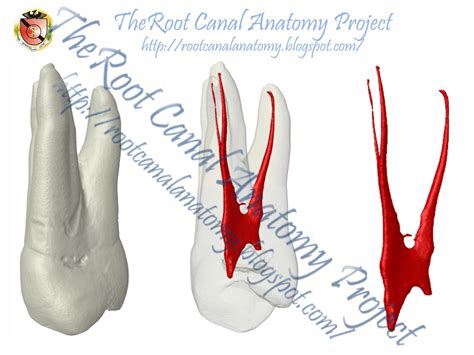 The Root Canal Anatomy Project Three Rooted Maxillary Premolar