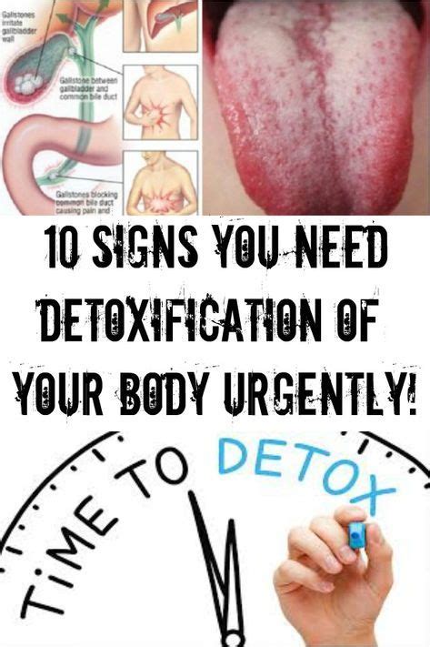 10 Signs You Need Detoxification Of Your Body Urgently Detox Your