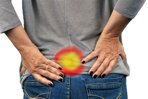 Is Sciatica Causing My Buttock Pain? - PMIR