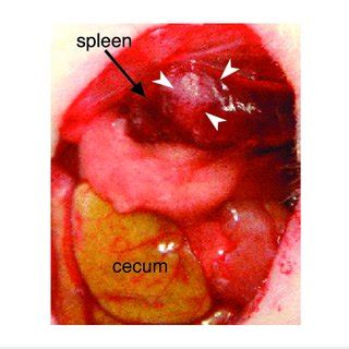 Experimental Metastasis Of KATO III Cells In Nude Mice Sd