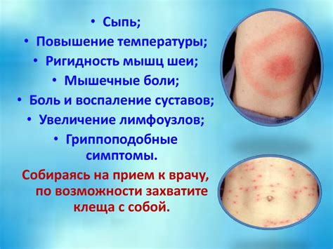 Укусы клещей - презентация онлайн