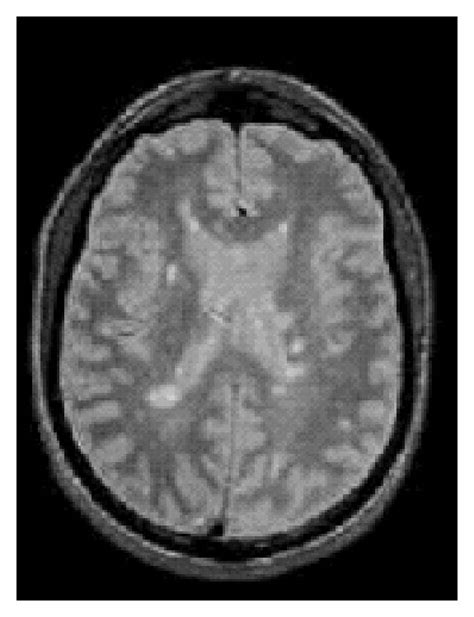 A The Brain Magnetic Resonance Image Mri B Mri’s Histogram Download Scientific Diagram