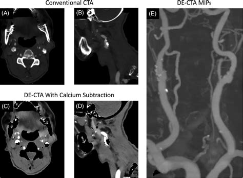 Clinical Applications Of Dualenergy Computed Tomography For Acute