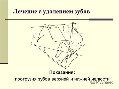 Презентация на тему: "Методы лечения зубочелюстных аномалий и ...